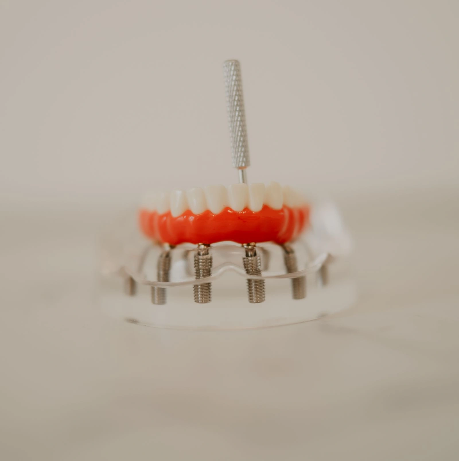 Dentalna implantologija